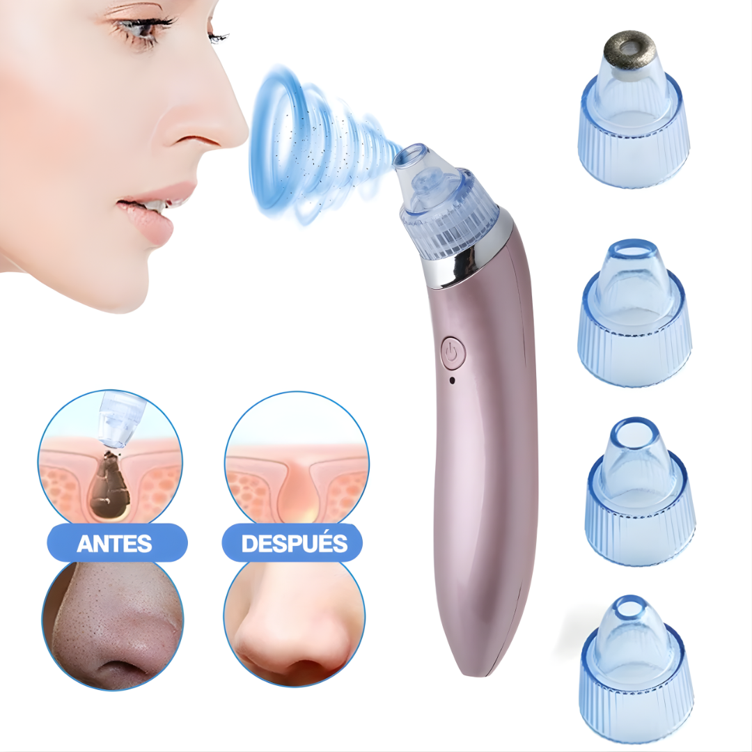 EXTRACTOR DE PUNTOS NEGROS – Limpieza profunda de poros, piel más suave y cuidado facial desde casa