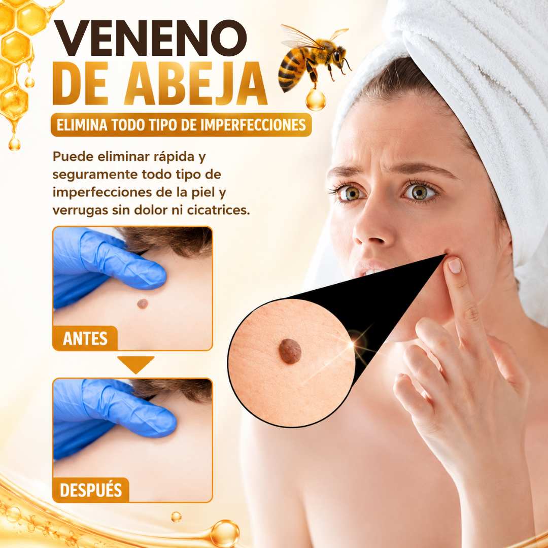 TAG RECEDE VENENO DE ABEJAS – Cuidado localizado para verrugas