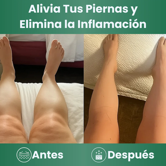 LYMPHATIC DRAINAGE: EXTRACTO HERBAL LÍQUIDO NATURE'S – Drenaje y ligereza diaria