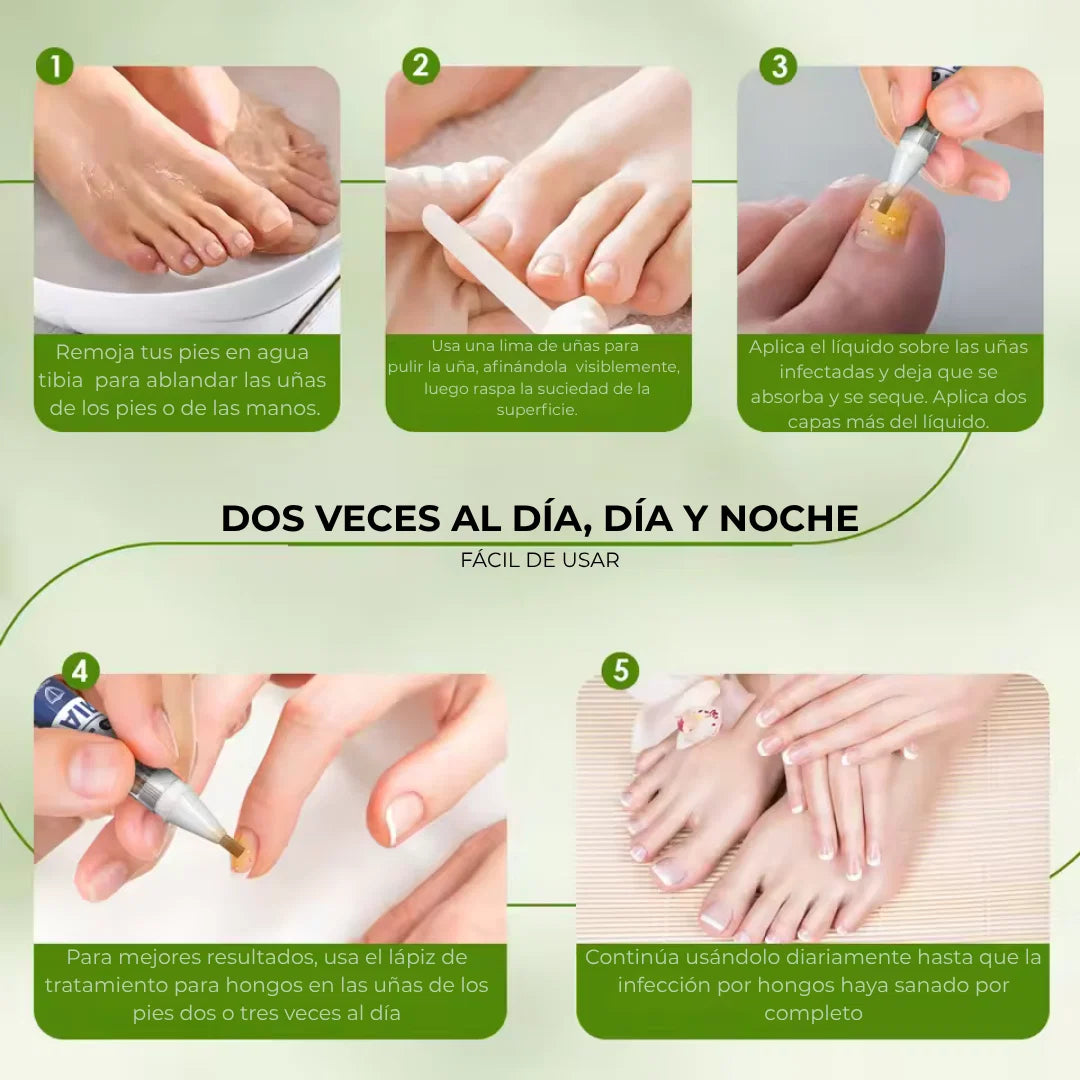 MyCurePro® · Elimina hongos en pies y manos · 7 días