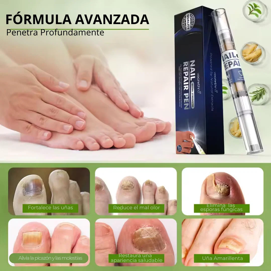 MyCurePro® · Elimina hongos en pies y manos · 7 días
