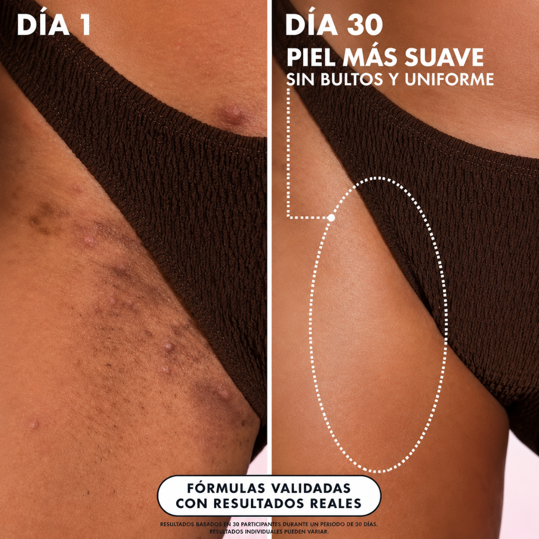 TRULLY – Aceite post afeitado para tono uniforme, axilas suaves y menos vellos encarnados