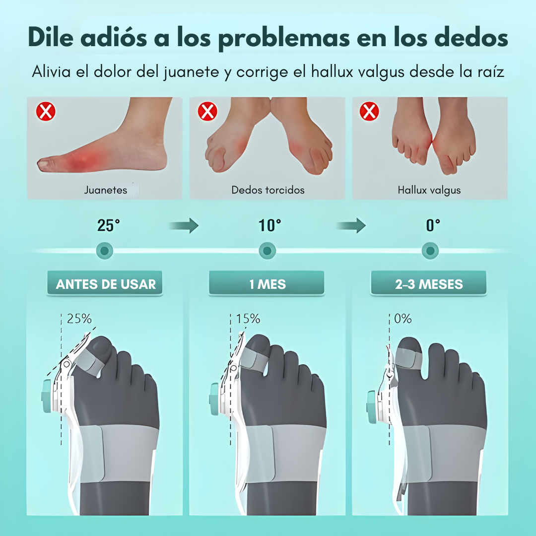 CORRECTOR DE JUANETES – Alivio progresivo, alineación natural y mayor comodidad al caminar