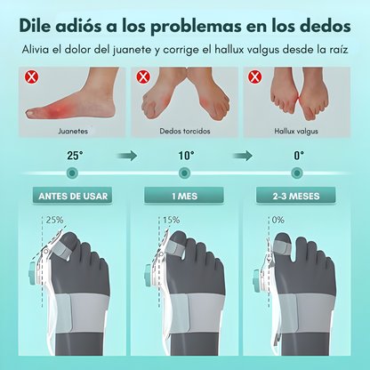CORRECTOR DE JUANETES – Alivio progresivo, alineación natural y mayor comodidad al caminar