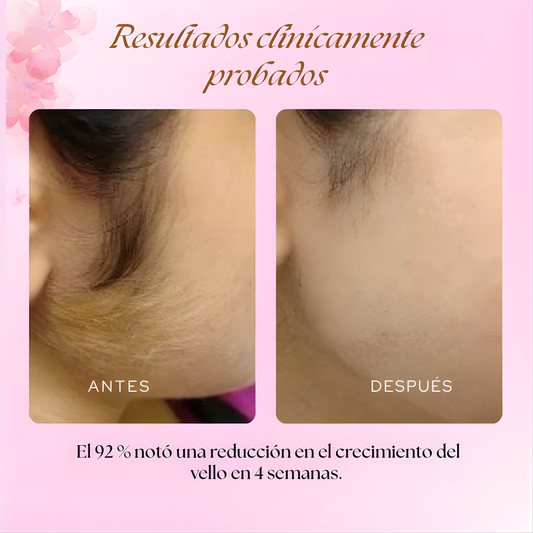 CARAMELA BEAUTY CYPERUS ROTUNDUS — Vello más lento, piel más suave, sin láser ni químicos agresivos