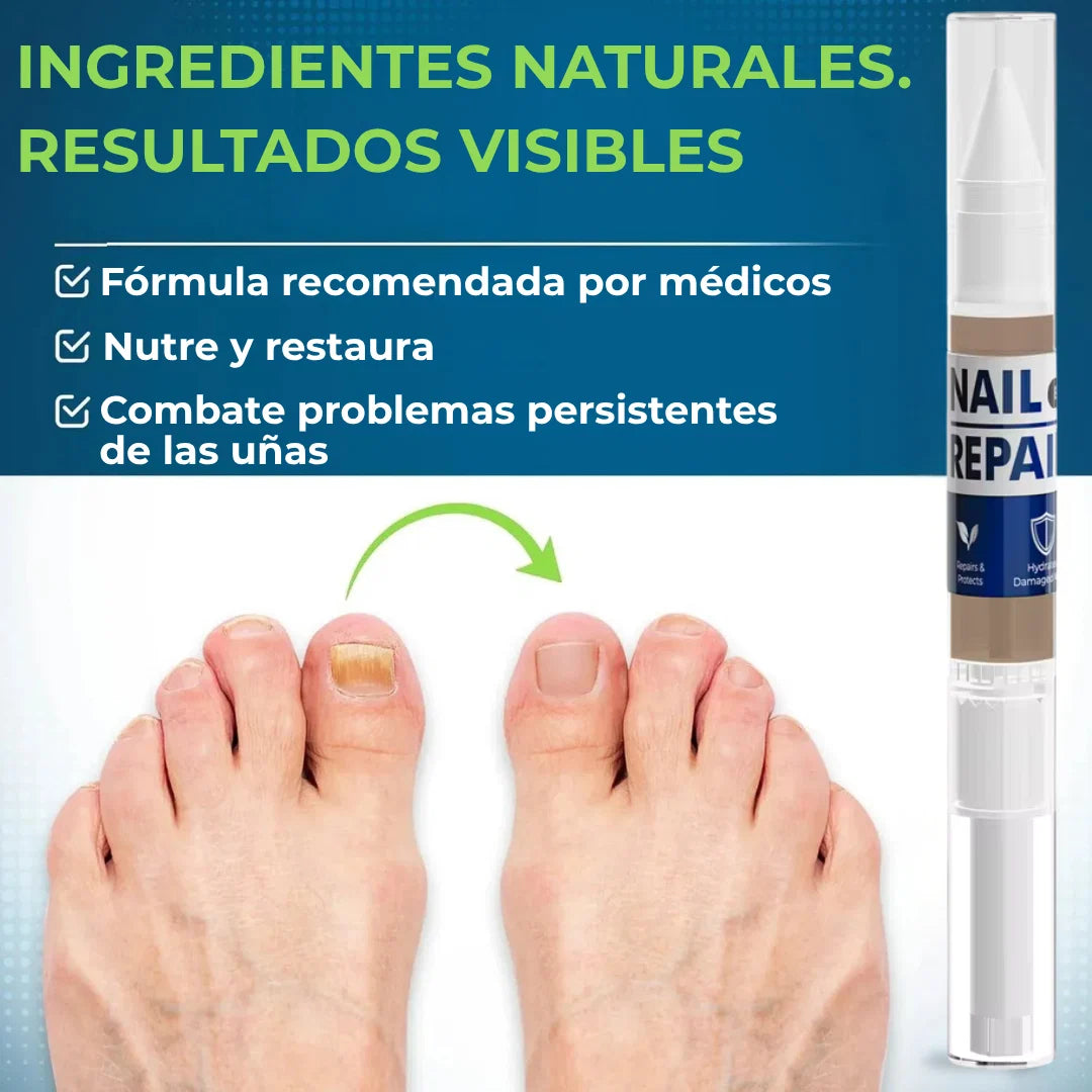 MyCurePro® · Elimina hongos en pies y manos · 7 días