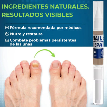 MyCurePro® · Elimina hongos en pies y manos · 7 días