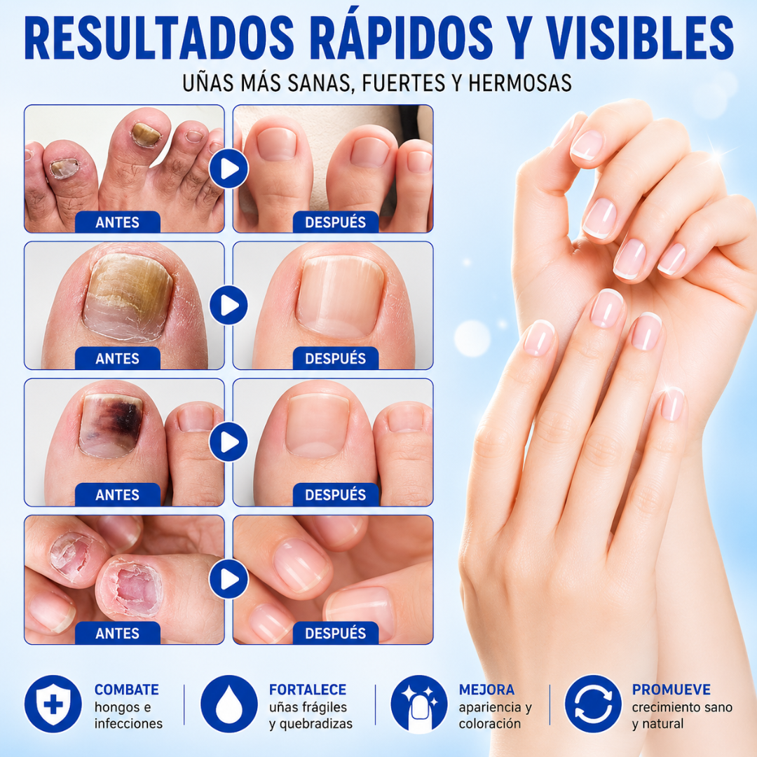 FUNGAL NAIL PATCHES – Cuidado visible para uñas