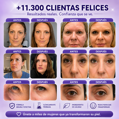 PARCHES MICROAGUJAS – Piel firme y renovada