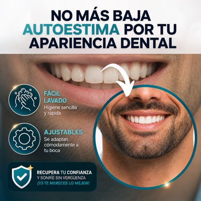 CARILLAS DENTALES SNAPON SMILE – Sonrisa renovada al instante