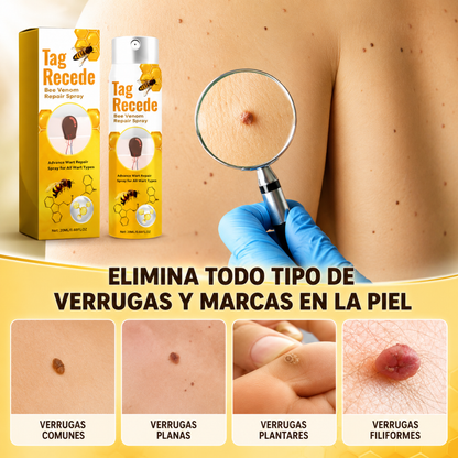 TAG RECEDE VENENO DE ABEJAS – Cuidado localizado para verrugas