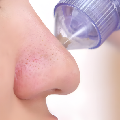 EXTRACTOR DE PUNTOS NEGROS – Limpieza profunda de poros, piel más suave y cuidado facial desde casa