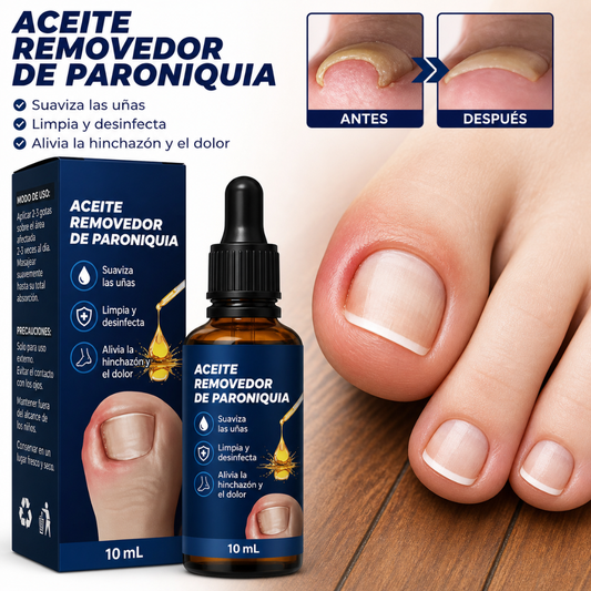 ACEITE PARA UÑA ENCARNADA (2 UNIDADES) — Alivia el dolor, ablanda el tejido y corrige la uña desde la raíz sin cirugía