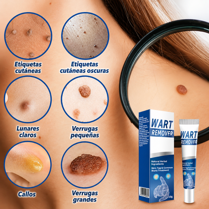 CREMA PARA ELIMINAR VERRUGAS – Cuidado localizado para imperfecciones