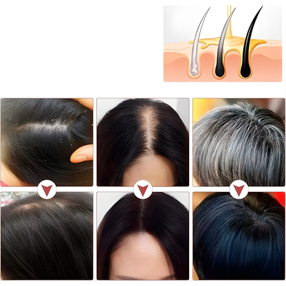 JABÓN SHAMPOO PARA EL CRECIMIENTO DEL CABELLO – Limpieza profunda, fortalecimiento capilar y cuidado del cuero cabelludo