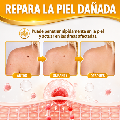 TAG RECEDE VENENO DE ABEJAS – Cuidado localizado para verrugas