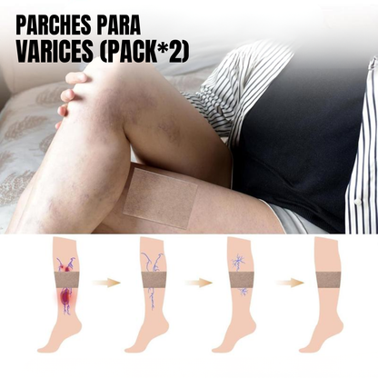 PARCHES ANTIVARICES L (PACK*2) – Alivio natural, circulación activa y piernas ligeras cada día
