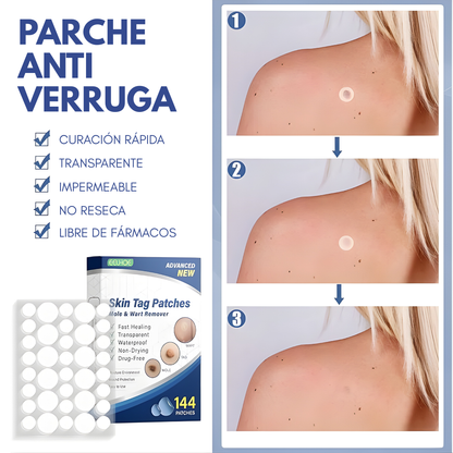 PARCHE ANTI VERRUGA – Eliminación progresiva, cuidado preciso y piel más uniforme sin complicaciones