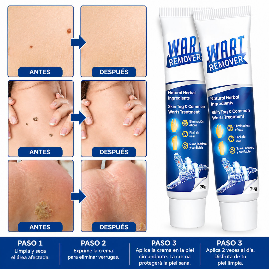 CREMA PARA ELIMINAR VERRUGAS – Cuidado localizado para imperfecciones