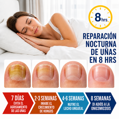 FUNGAL NAIL PATCHES – Cuidado visible para uñas