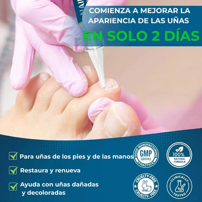 MyCurePro® · Elimina hongos en pies y manos · 7 días