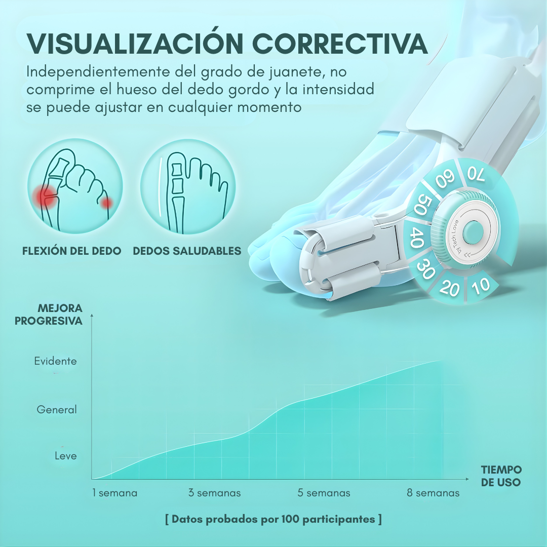 CORRECTOR DE JUANETES – Alivio progresivo, alineación natural y mayor comodidad al caminar