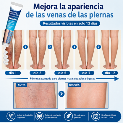 CREMA PARA ALIVIAR LAS VARICES – Alivio para piernas cansadas