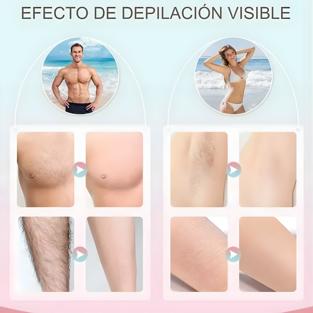 DEPILADORA LASER IPL (LUZ PULSADA INTENSA) – Piel suave y sin vello desde casa, sin dolor ni salones