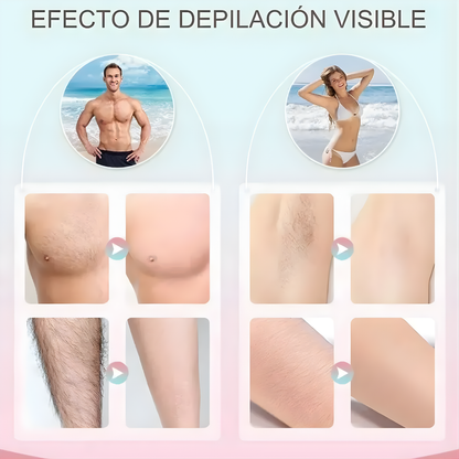 DEPILADORA LASER IPL (LUZ PULSADA INTENSA) – Piel suave y sin vello desde casa, sin dolor ni salones