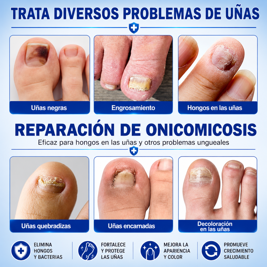 FUNGAL NAIL PATCHES – Cuidado visible para uñas