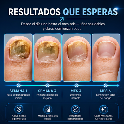 LÁPIZ DE HONGOS – Cuidado localizado y preciso
