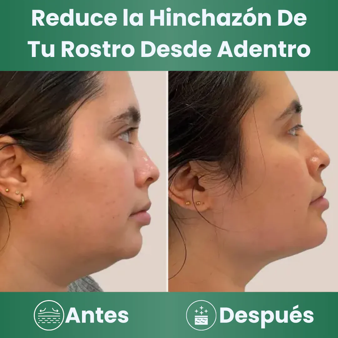 LYMPHATIC DRAINAGE: EXTRACTO HERBAL LÍQUIDO NATURE'S – Drenaje y ligereza diaria