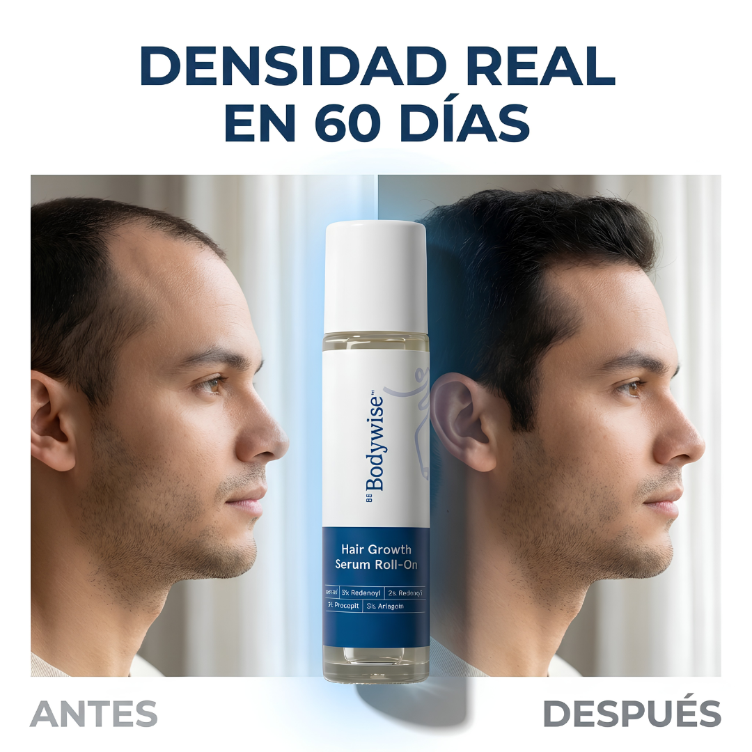 BODYWISE-50 ML — Apoyo para entradas, barba y densidad capilar masculina