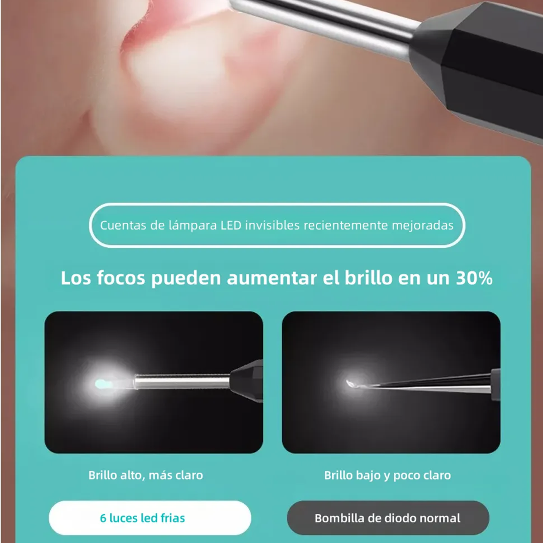 REMOVEDOR DE CERUMEN CON CÁMARA — Ve lo que hay dentro y límpialo de verdad, sin cotonetes y sin riesgo