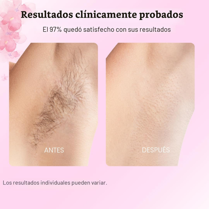 CARAMELA BEAUTY CYPERUS ROTUNDUS — Vello más lento, piel más suave, sin láser ni químicos agresivos