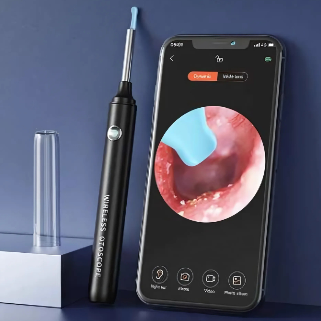 REMOVEDOR DE CERUMEN CON CÁMARA — Ve lo que hay dentro y límpialo de verdad, sin cotonetes y sin riesgo