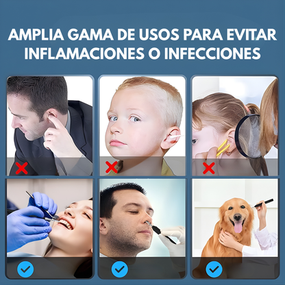 LIMPIADOR DE OÍDOS CON CÁMARA – Limpieza visual, control total y cuidado seguro para tus oídos